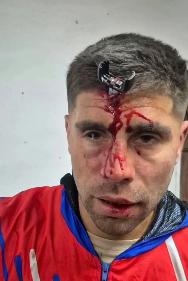 Salvaje ataque a un jugador del Ascenso: le clavaron una llave en la cabeza
