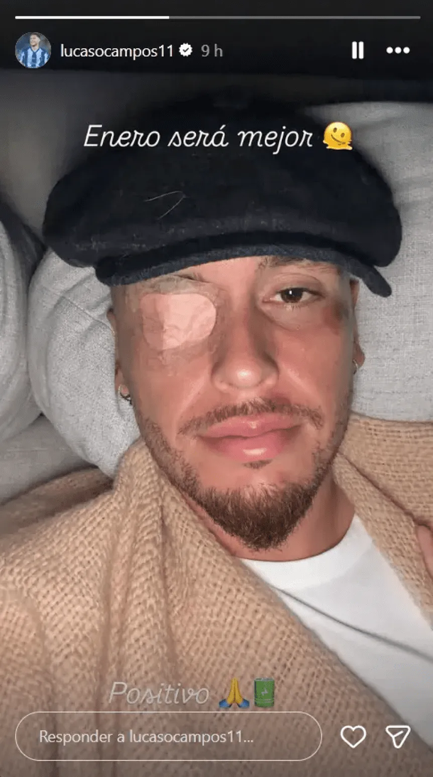 El sufrido presente de Lucas Ocampos: tiene una parálisis facial luego de una fractura El sufrido presente de Lucas Ocampos: tiene una parálisis facial luego de una fractura