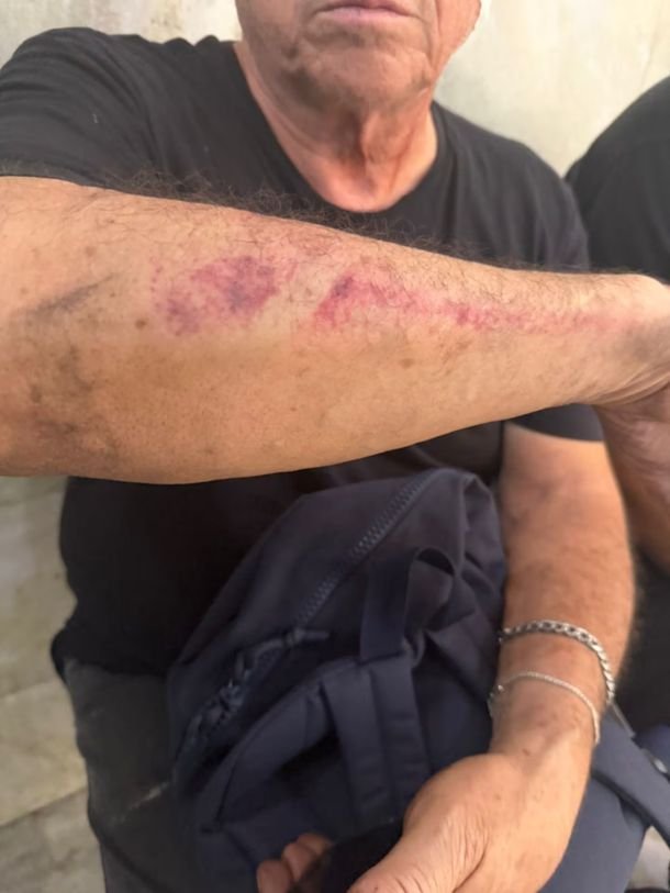 Dramático testimonio del hombre al que su hijo quiso atropellar: «Ojalá no lo vea hasta que me muera» Dramático testimonio del hombre al que su hijo quiso atropellar: «Ojalá no lo vea hasta que me muera»