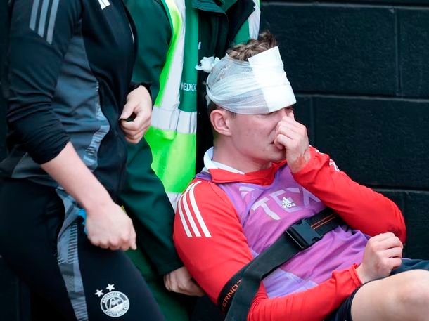 Escocia: un hincha fue condenado a prisión por provocar una lesión irreversible a un jugador